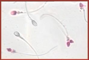 Frammentazione Spermatozoi